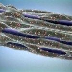 Соль вызывает астму и рассеянный склероз Соль вызывает астму и рассеянный склероз